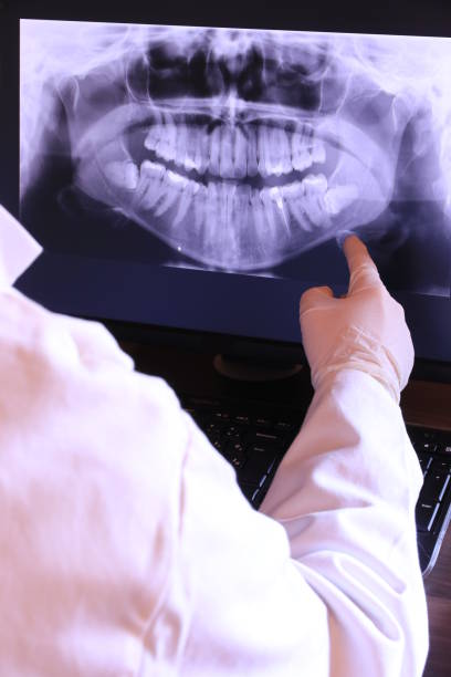 Best Emergency Broken Tooth Repair in Mec, CA