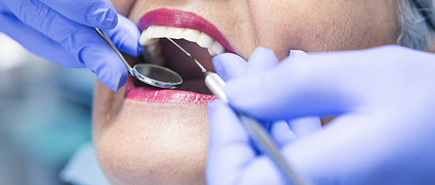 Best Emergency Treatment for Toothache in Mec, CA